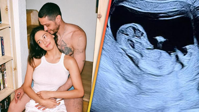 Pete Davidson Expecting First Child With Girlfriend Elsie Hewitt